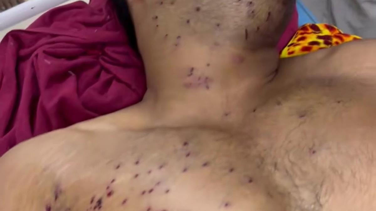 Controversy erupts over pellet gun use on protesting students