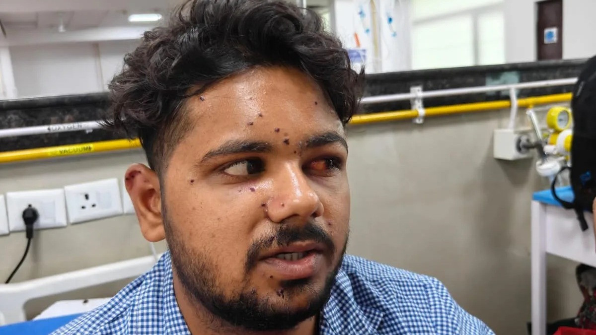 MBA graduate claims RAF fired pellet gun during protest